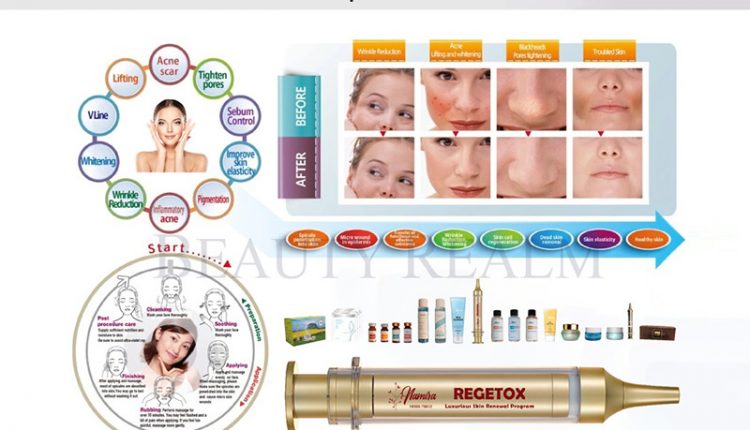 vi kim sinh học có tốt không